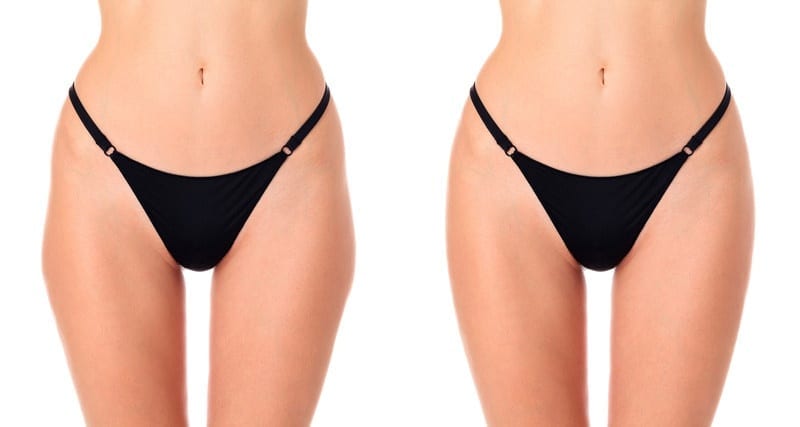 how-to-get-rid-of-saddlebags-on-thighs